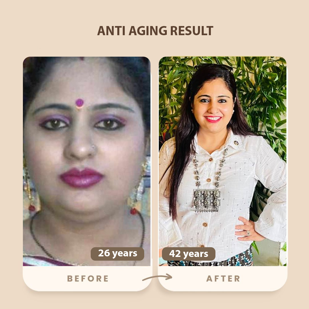 Anti Aging