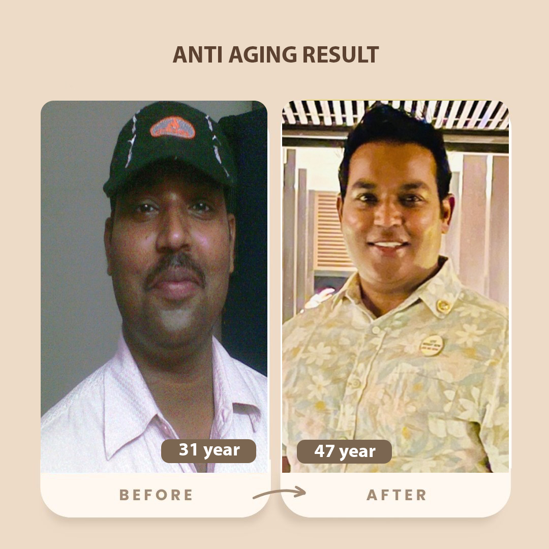 Anti Aging