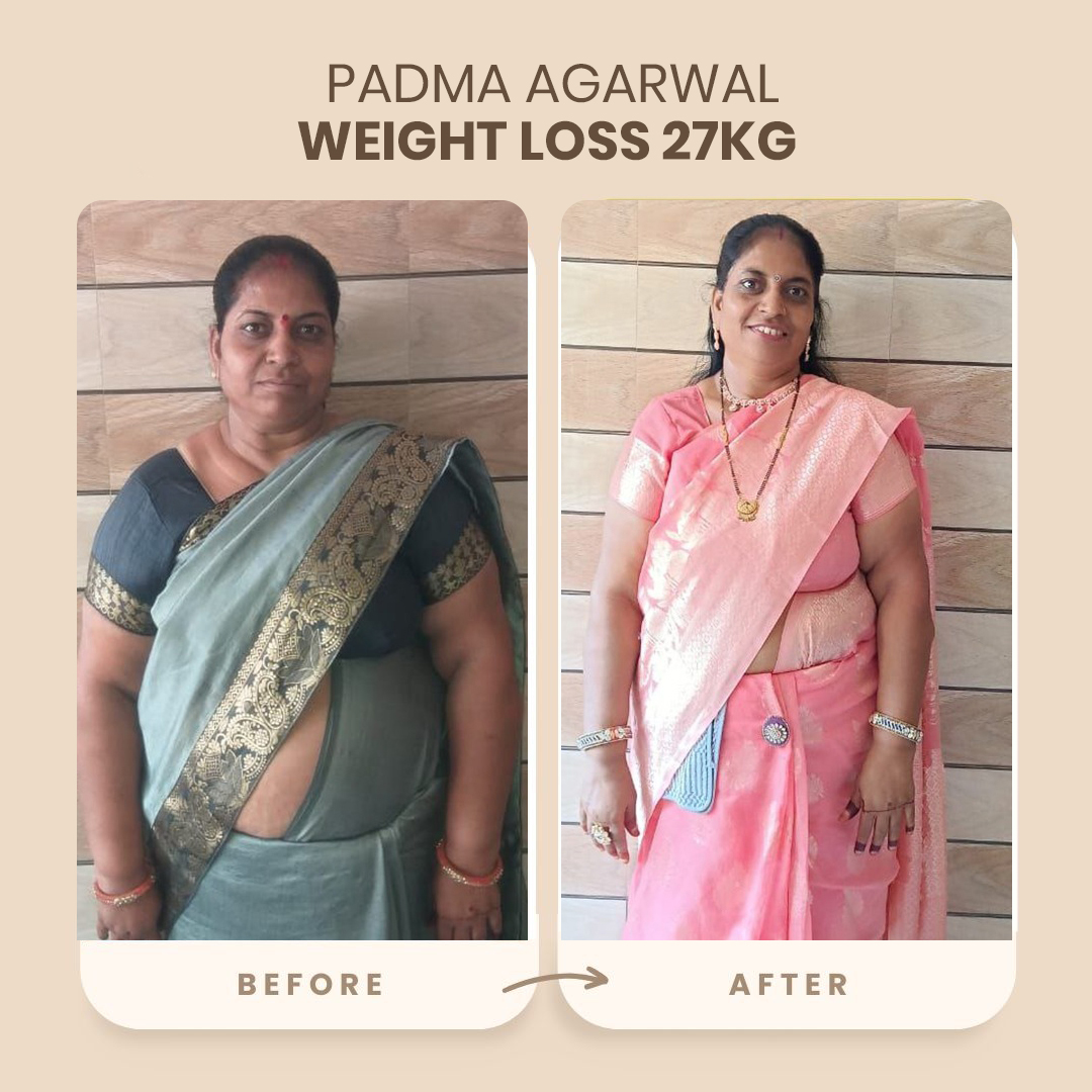 Weight Loss Transformation